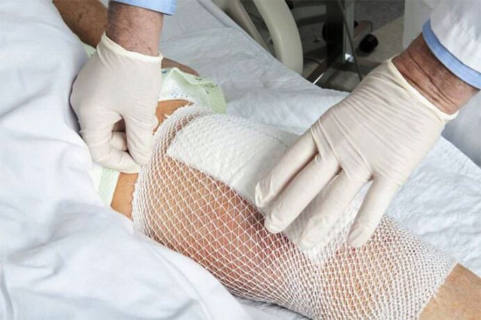 Therapeutic dressing for arthrosis of the knee joint