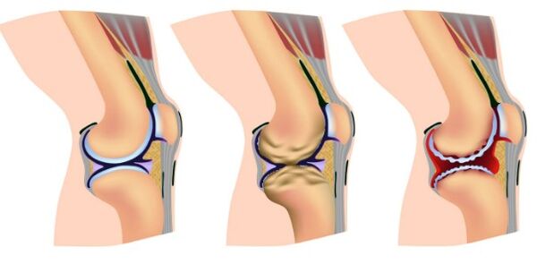 Deformation phases of the knee joint