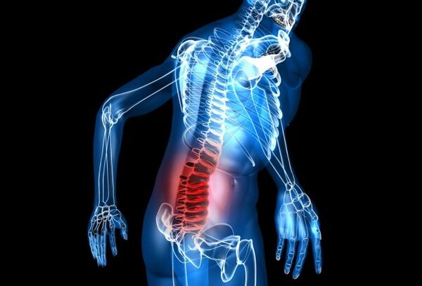 Symptoms of osteochondrose
