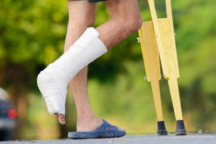 ankle joint injury as a cause of arthrosis
