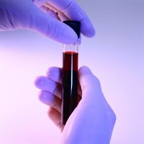 Blood in the test pipe