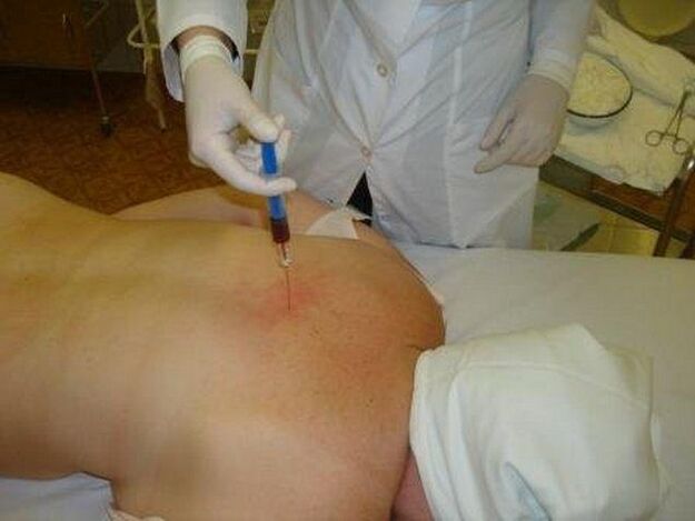 Preparations for osteochondrose